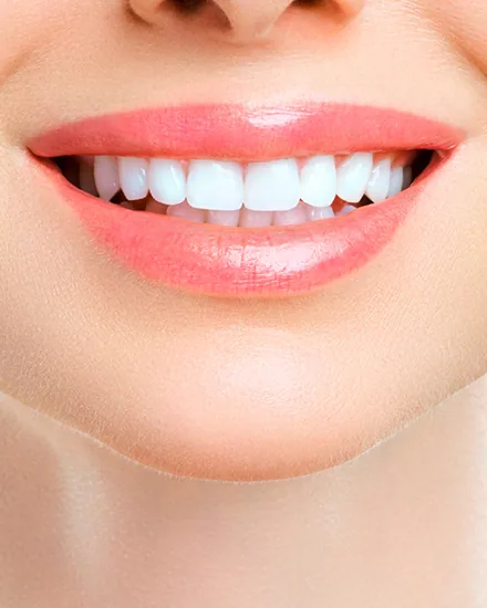Sorriso com dentes brancos e alinhados