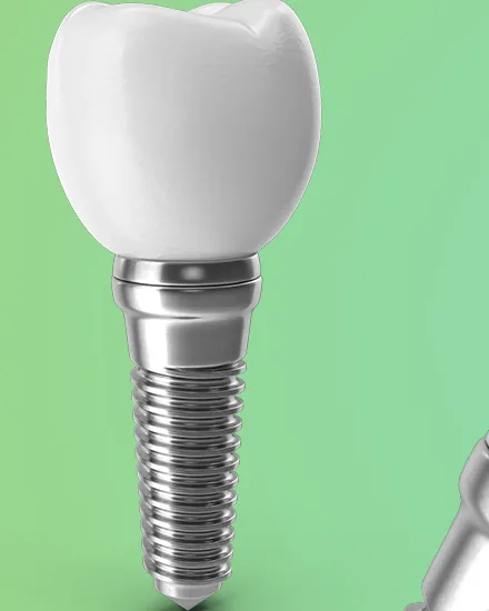 Implante dentário com coroa de porcelana