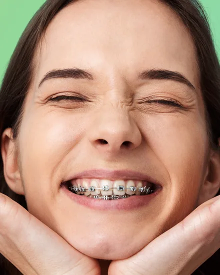 Paciente sorrindo com aparelho ortodôntico