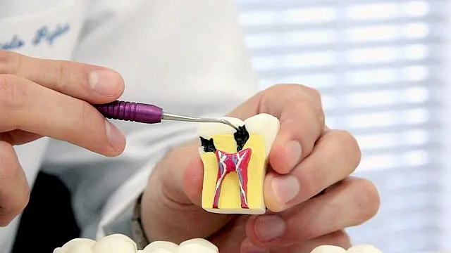 Mãos de dentista apontando com uma sonda para um modelo de dente em corte, que mostra a polpa