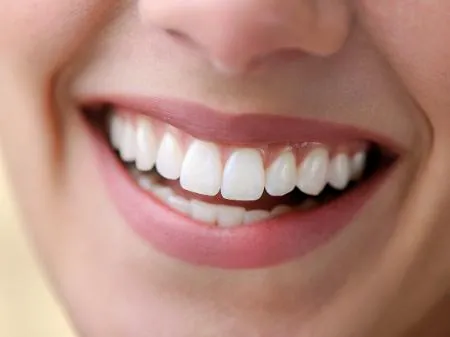 Afinal, dente de porcelana pode quebrar?