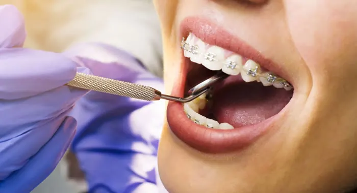 Dentista examinando dentes de paciente com aparelho fixo