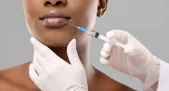 Aplicação de preenchimento com seringa no lábio de uma mulher negra