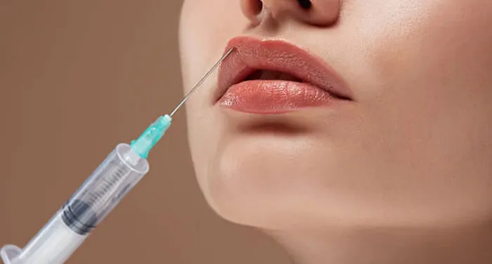 Seringa aplicando ácido hialurônico no lábio inferior, vista de perfil