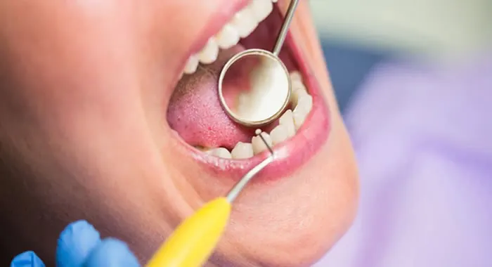Dentista examinando os dentes de uma paciente com espelho clínico