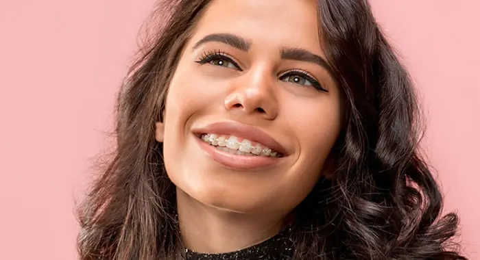 Mulher sorrindo com aparelho fixo de bráquetes claros