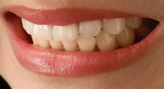 Close de dentes da arcada superior e inferior