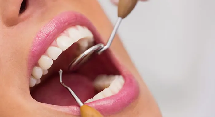 Exame odontológico com espelho clínico e sonda