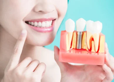 woman-dental-implant-model